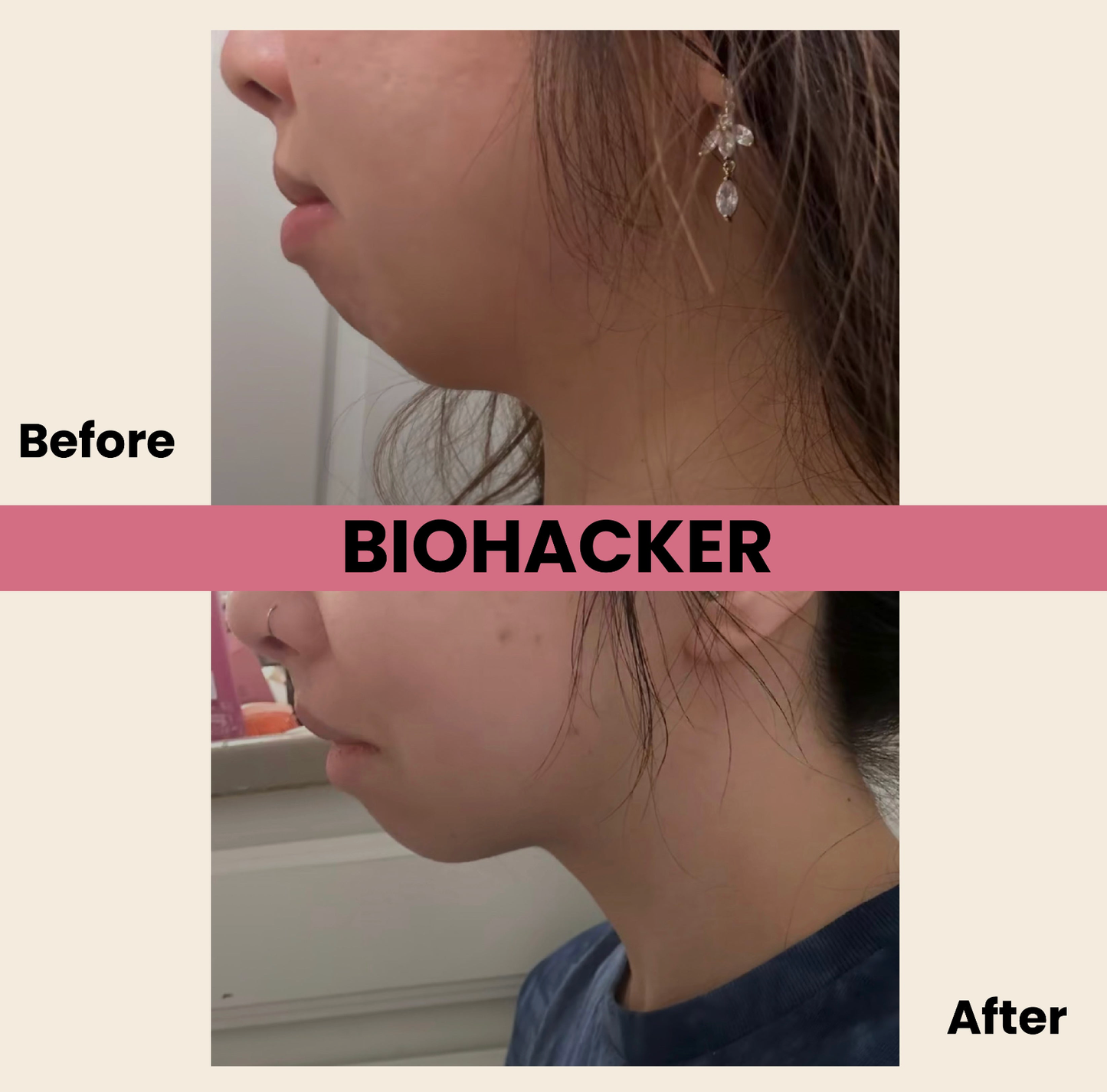 Sleep Soundly_ No More Dry Mouth _Mouth Tape